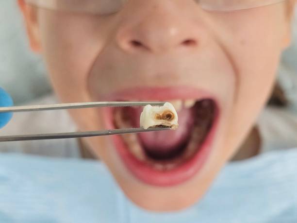 Best Urgent Tooth Repair  in Lake Park, NC